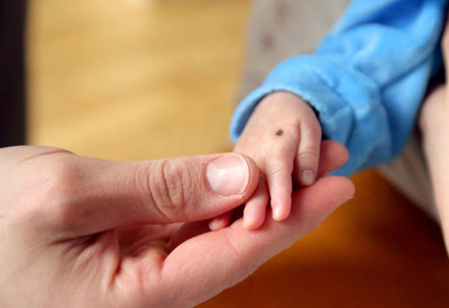 Grain de beauté sur la main d'un bébé