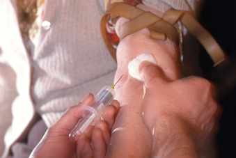 Visuel présentant les mains d'une personne effectuant une prise de sang dans le brad d'un patient